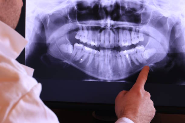 Best Tooth Pain Emergency Relief  in Port Orchard, WA