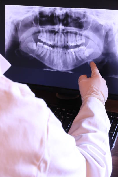 Tooth Infection Emergency Dentist in WA